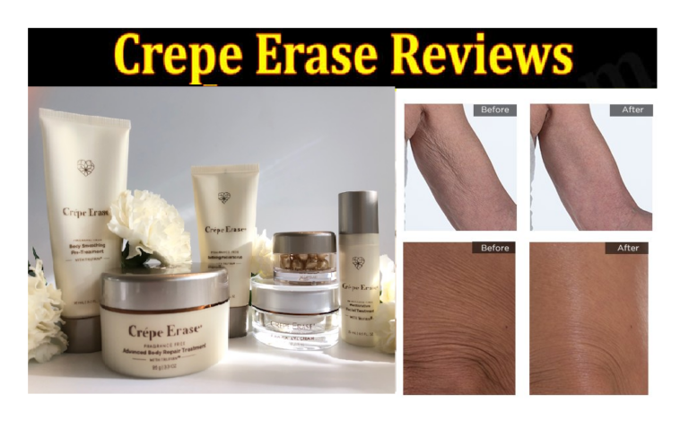 Crepe Erase Review: What You Need to Know Before You Shop